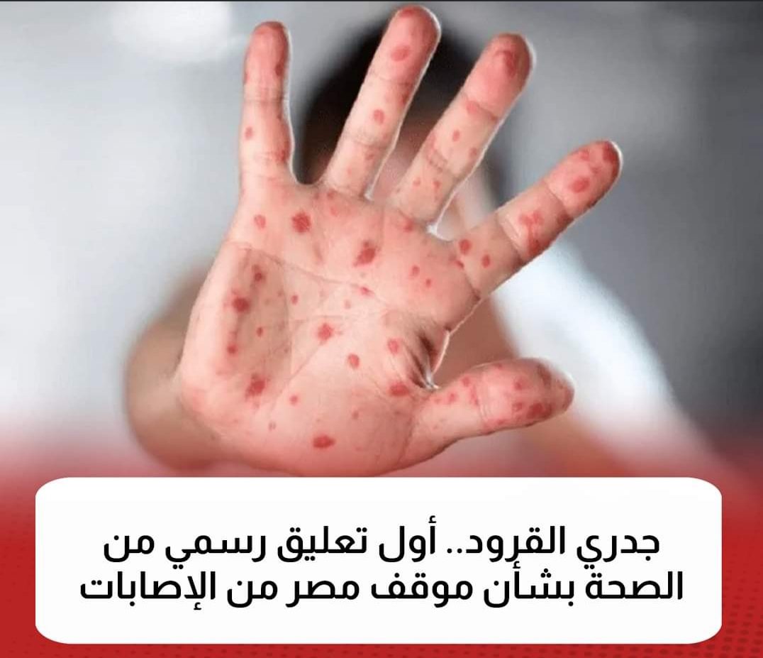 تحذير عاجل من وزارة الصحة المصرية عن جدري القرود بعد انتشاره في العالم و استهدافه للأطفال - اخبار الصحة